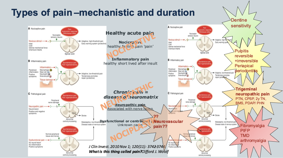 Pain Neuropathic Pain Definition Diagnosis Classification And
